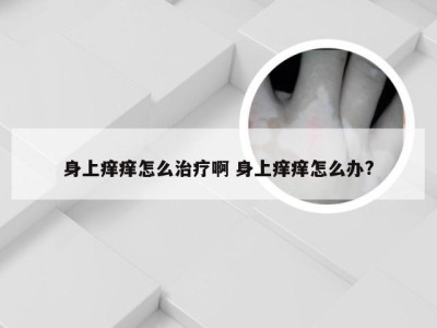 身上痒痒怎么治疗啊 身上痒痒怎么办?