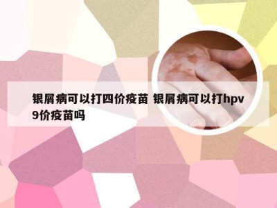 银屑病可以打四价疫苗 银屑病可以打hpv9价疫苗吗