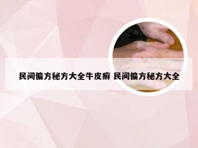 民间偏方秘方大全牛皮癣 民间偏方秘方大全