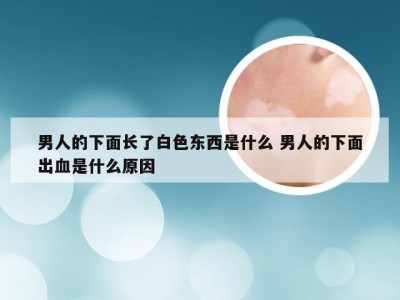 男人的下面长了白色东西是什么 男人的下面出血是什么原因