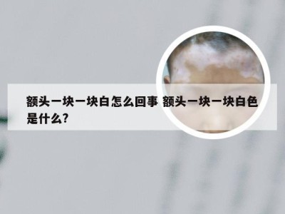 额头一块一块白怎么回事 额头一块一块白色是什么?