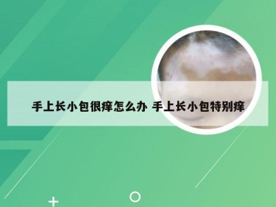 手上长小包很痒怎么办 手上长小包特别痒