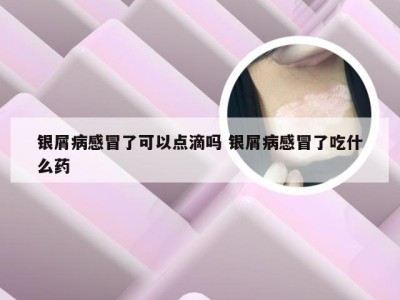 银屑病感冒了可以点滴吗 银屑病感冒了吃什么药