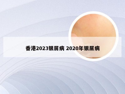 香港2023银屑病 2020年银屑病