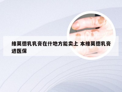 维莫德乳乳膏在什地方能卖上 本维莫德乳膏进医保