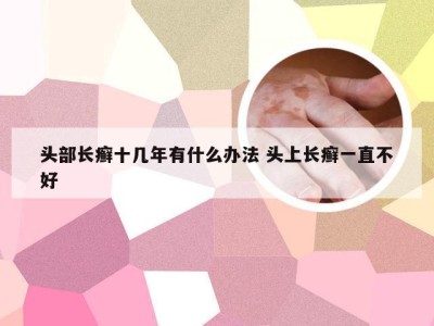 头部长癣十几年有什么办法 头上长癣一直不好