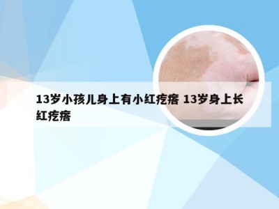 13岁小孩儿身上有小红疙瘩 13岁身上长红疙瘩