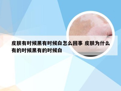 皮肤有时候黑有时候白怎么回事 皮肤为什么有的时候黑有的时候白