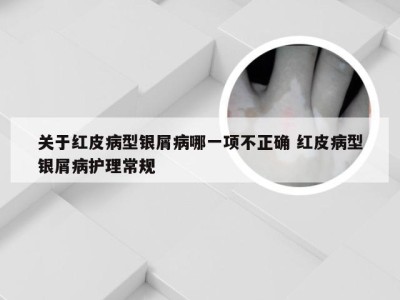 关于红皮病型银屑病哪一项不正确 红皮病型银屑病护理常规