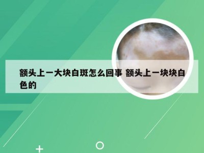 额头上一大块白斑怎么回事 额头上一块块白色的