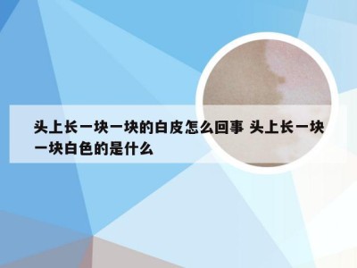 头上长一块一块的白皮怎么回事 头上长一块一块白色的是什么