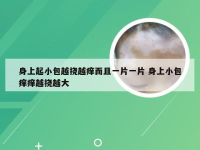 身上起小包越挠越痒而且一片一片 身上小包痒痒越挠越大