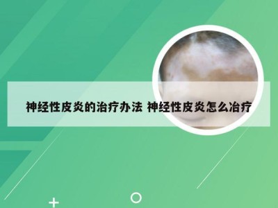 神经性皮炎的治疗办法 神经性皮炎怎么冶疗