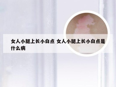 女人小腿上长小白点 女人小腿上长小白点是什么病