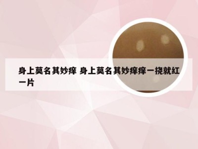 身上莫名其妙痒 身上莫名其妙痒痒一挠就红一片