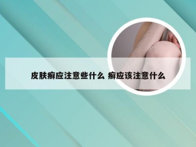 皮肤癣应注意些什么 癣应该注意什么