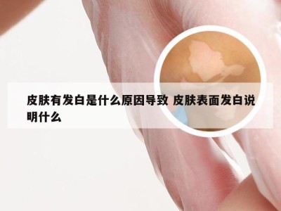 皮肤有发白是什么原因导致 皮肤表面发白说明什么