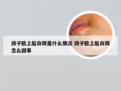 孩子脸上起白斑是什么情况 孩子脸上起白斑怎么回事