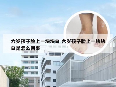 六岁孩子脸上一块块白 六岁孩子脸上一块块白是怎么回事