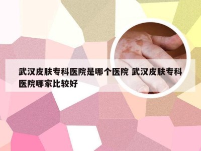 武汉皮肤专科医院是哪个医院 武汉皮肤专科医院哪家比较好