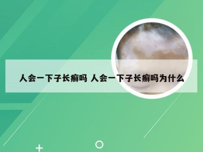 人会一下子长癣吗 人会一下子长癣吗为什么