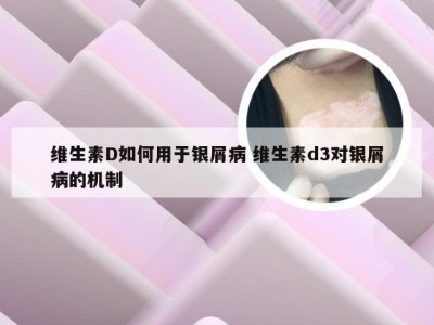 维生素D如何用于银屑病 维生素d3对银屑病的机制