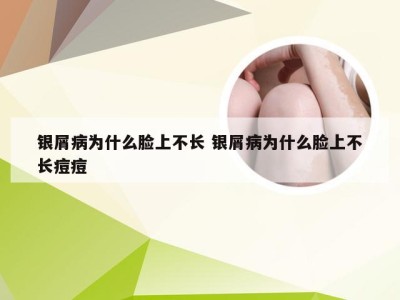 银屑病为什么脸上不长 银屑病为什么脸上不长痘痘