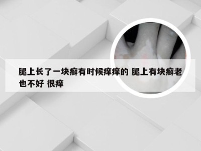 腿上长了一块癣有时候痒痒的 腿上有块癣老也不好 很痒