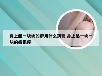 身上起一块块的癣用什么药膏 身上起一块一块的癣很痒