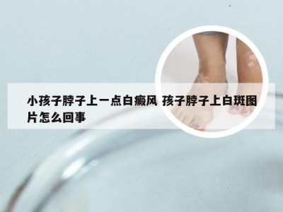 小孩子脖子上一点白癜风 孩子脖子上白斑图片怎么回事