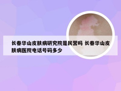 长春华山皮肤病研究院是民营吗 长春华山皮肤病医院电话号码多少