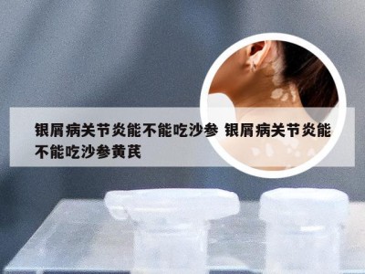 银屑病关节炎能不能吃沙参 银屑病关节炎能不能吃沙参黄芪