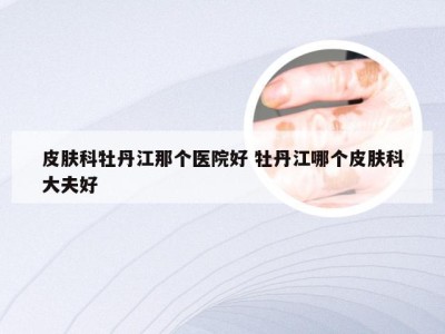 皮肤科牡丹江那个医院好 牡丹江哪个皮肤科大夫好