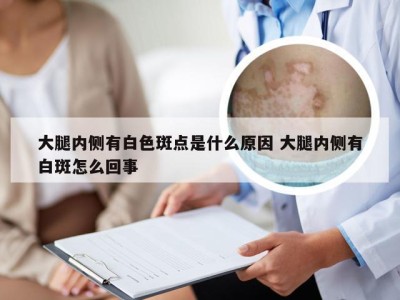 大腿内侧有白色斑点是什么原因 大腿内侧有白斑怎么回事