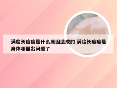 满脸长痘痘是什么原因造成的 满脸长痘痘是身体哪里出问题了