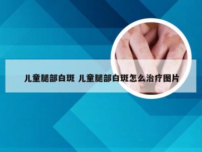 儿童腿部白斑 儿童腿部白斑怎么治疗图片