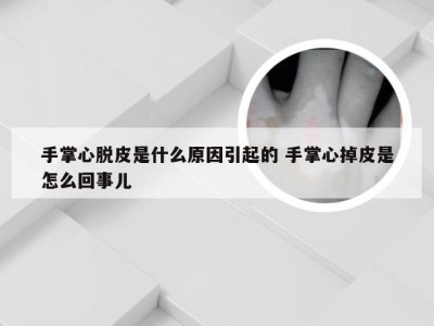 手掌心脱皮是什么原因引起的 手掌心掉皮是怎么回事儿