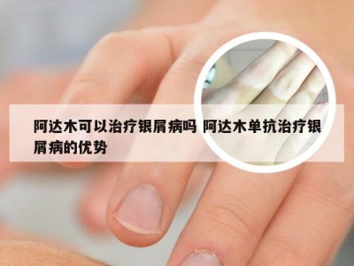 阿达木可以治疗银屑病吗 阿达木单抗治疗银屑病的优势