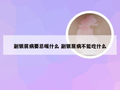 副银屑病要忌嘴什么 副银屑病不能吃什么