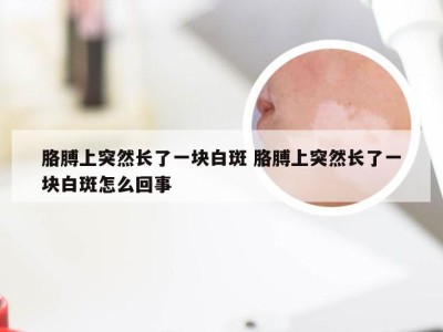 胳膊上突然长了一块白斑 胳膊上突然长了一块白斑怎么回事