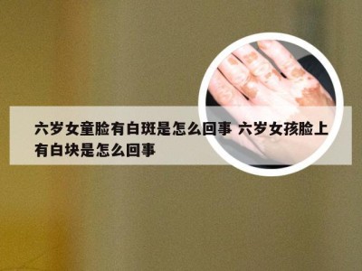 六岁女童脸有白斑是怎么回事 六岁女孩脸上有白块是怎么回事