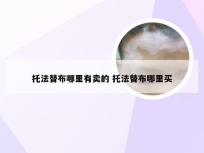 托法替布哪里有卖的 托法替布哪里买