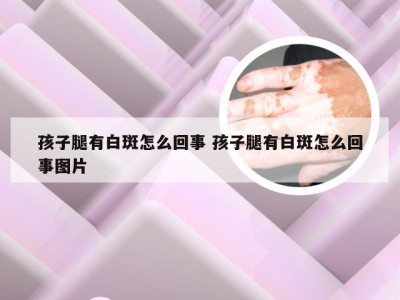 孩子腿有白斑怎么回事 孩子腿有白斑怎么回事图片