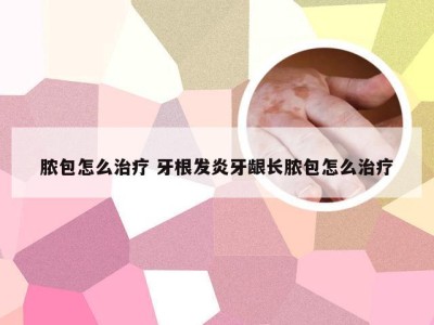 脓包怎么治疗 牙根发炎牙龈长脓包怎么治疗