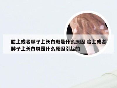 脸上或者脖子上长白斑是什么原因 脸上或者脖子上长白斑是什么原因引起的