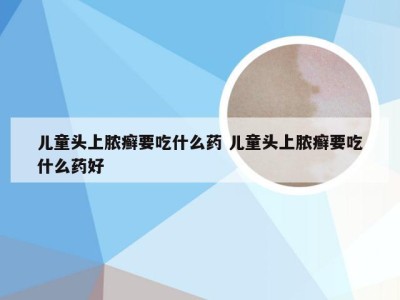 儿童头上脓癣要吃什么药 儿童头上脓癣要吃什么药好