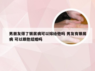 男朋友得了银屑病可以嫁给他吗 男友有银屑病 可以跟他结婚吗