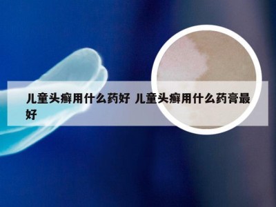 儿童头癣用什么药好 儿童头癣用什么药膏最好