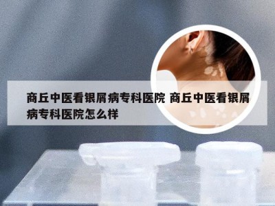 商丘中医看银屑病专科医院 商丘中医看银屑病专科医院怎么样