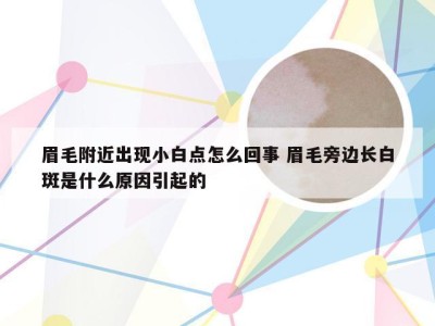 眉毛附近出现小白点怎么回事 眉毛旁边长白斑是什么原因引起的